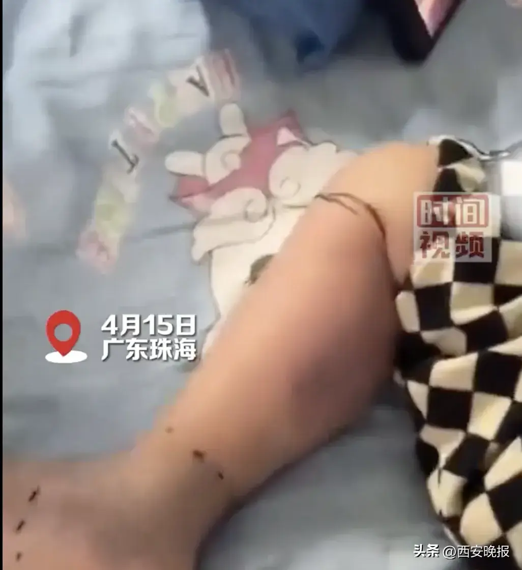 索赔22万！女子超市买鱼被刺八级伤残，每天得剜去腐肉，法院判了→-图10